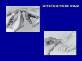Sensibilidade cinético-postural
 