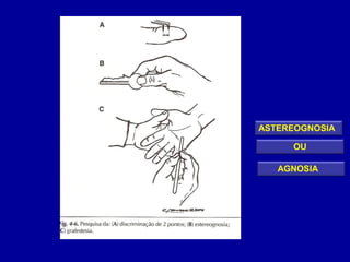 ASTEREOGNOSIA
AGNOSIA
OU
 
