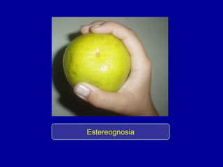 Estereognosia
 