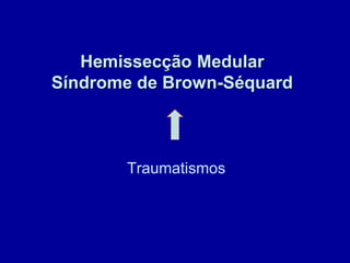 Hemissecção Medular
Síndrome de Brown-Séquard
Traumatismos
 