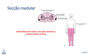 MFMM
Secção medular
Perda bilateral de todas as funções sensitivas e
motoras abaixo da lesão
 