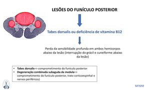 MFMM
LESÕES DO FUNÍCULO POSTERIOR
Tabes dorsalis ou deficiência de vitamina B12
Perda da sensibilidade profunda em ambos hemicorpos
abaixo da lesão (interrupção do grácil e cuneiforme abaixo
da lesão)
• Tabes dorsalis=> comprometimento do funículo posterior
• Degeneração combinada subaguda da medula=>
comprometimento do funículo posterior, trato corticoespinhal e
nervos periféricos)
 