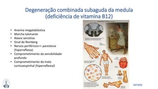 MFMM
Degeneração combinada subaguda da medula
(deficiência de vitamina B12)
• Anemia megaloblástica
• Marcha talonante
• Ataxia sensitiva
• Sinal de Romberg
• Nervos periféricos=> parestesia
(hiporreflexia)
• Comprometimento da sensibilidade
profunda
• Comprometimento do trato
corticoespinhal (hiperreflexia)l
 