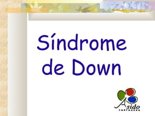 Síndrome
de Down
 