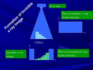 vi
In

le
ib
s

X-ray tube

Plot of incident x-ray
beam intensity

of
on ge
ti a
a
rm y im
Fo -ra
x

Object
Invisible x-ray
image

Plot of transmitted x-ray
beam intensity

 
