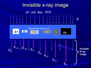 Invisible x-ray image
kV mA Sec FFD
E
Supporting tissue (m)

B
B1

EM

B2

E B1

E B2

T2

T1

ET1

EM

T3

Air

Invisible
X-ray
image

ET2
ET3

EA

 