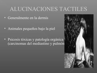 ALUCINACIONES TACTILES
• Generalmente en la dermis
• Animales pequeños bajo la piel
• Psicosis tóxicas y patología orgánica

(carcinomas del mediastino y pulmón)

 