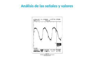 Análisis de las señales y valores
 