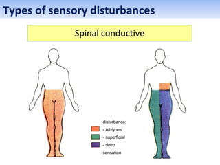 Spinal conductive
Types of sensory disturbances
disturbance:
- All types
- superficial
- deep
sensation
 
