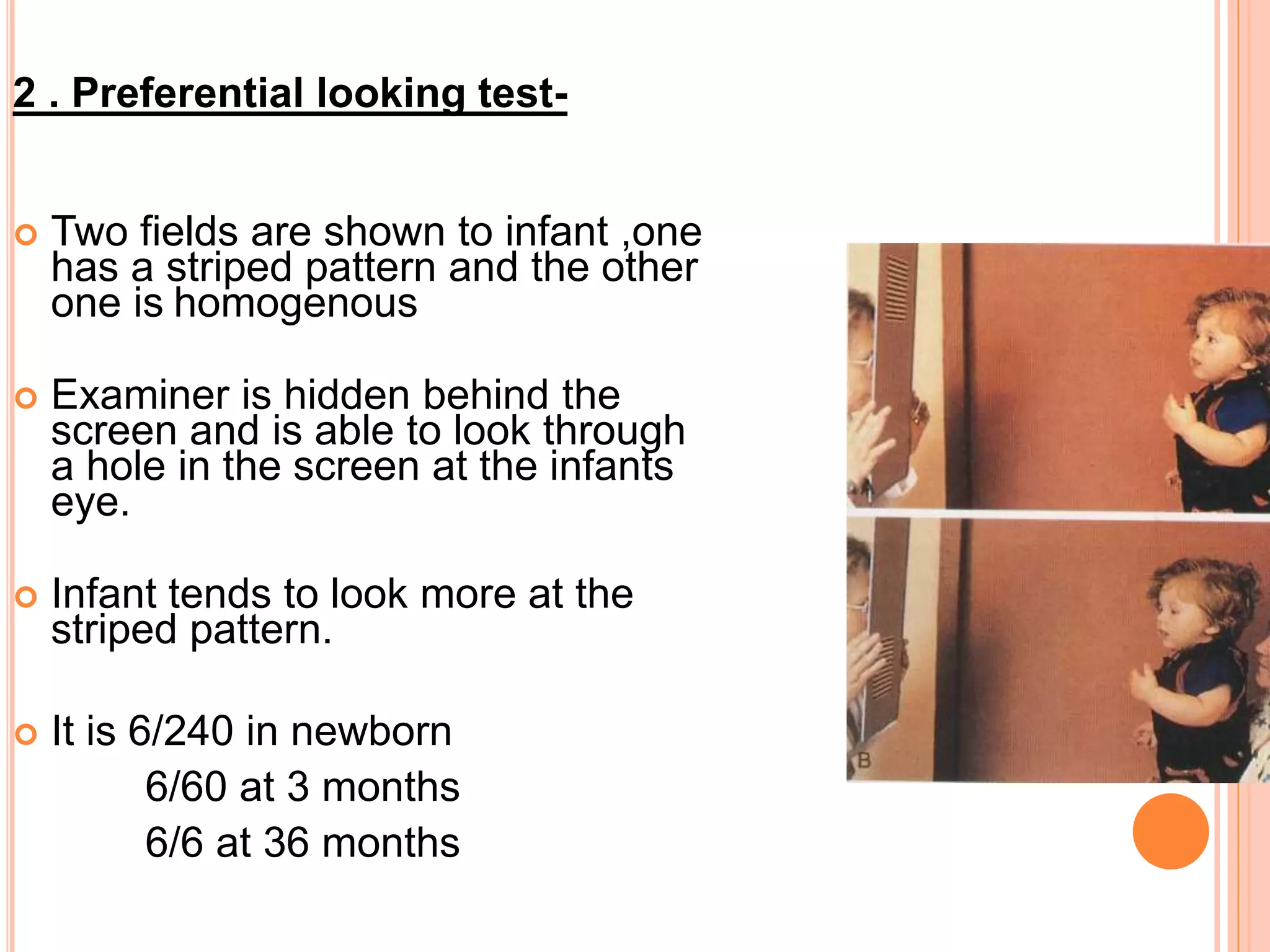 Sensory evaluation of squint PPT