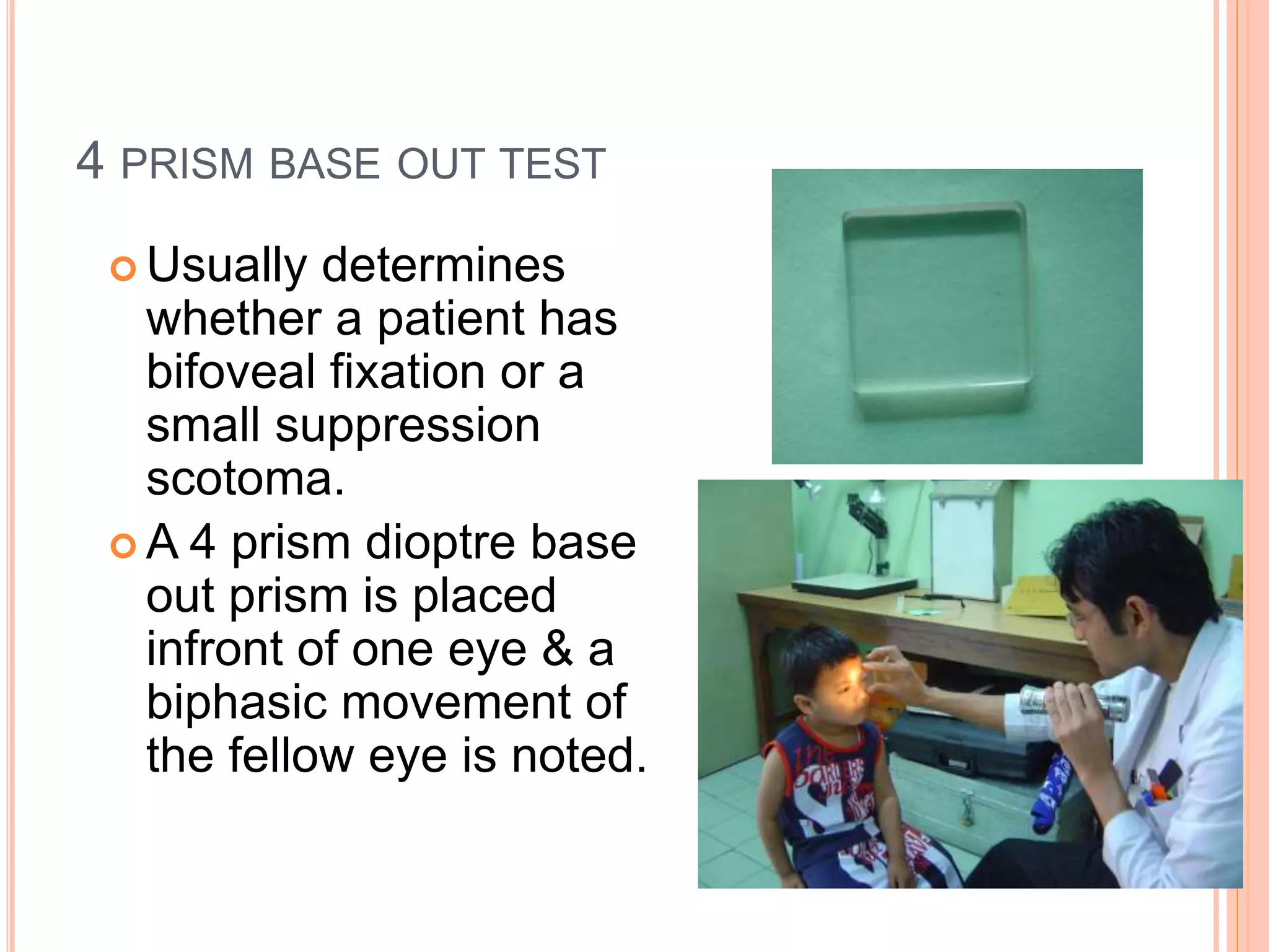 Sensory evaluation of squint