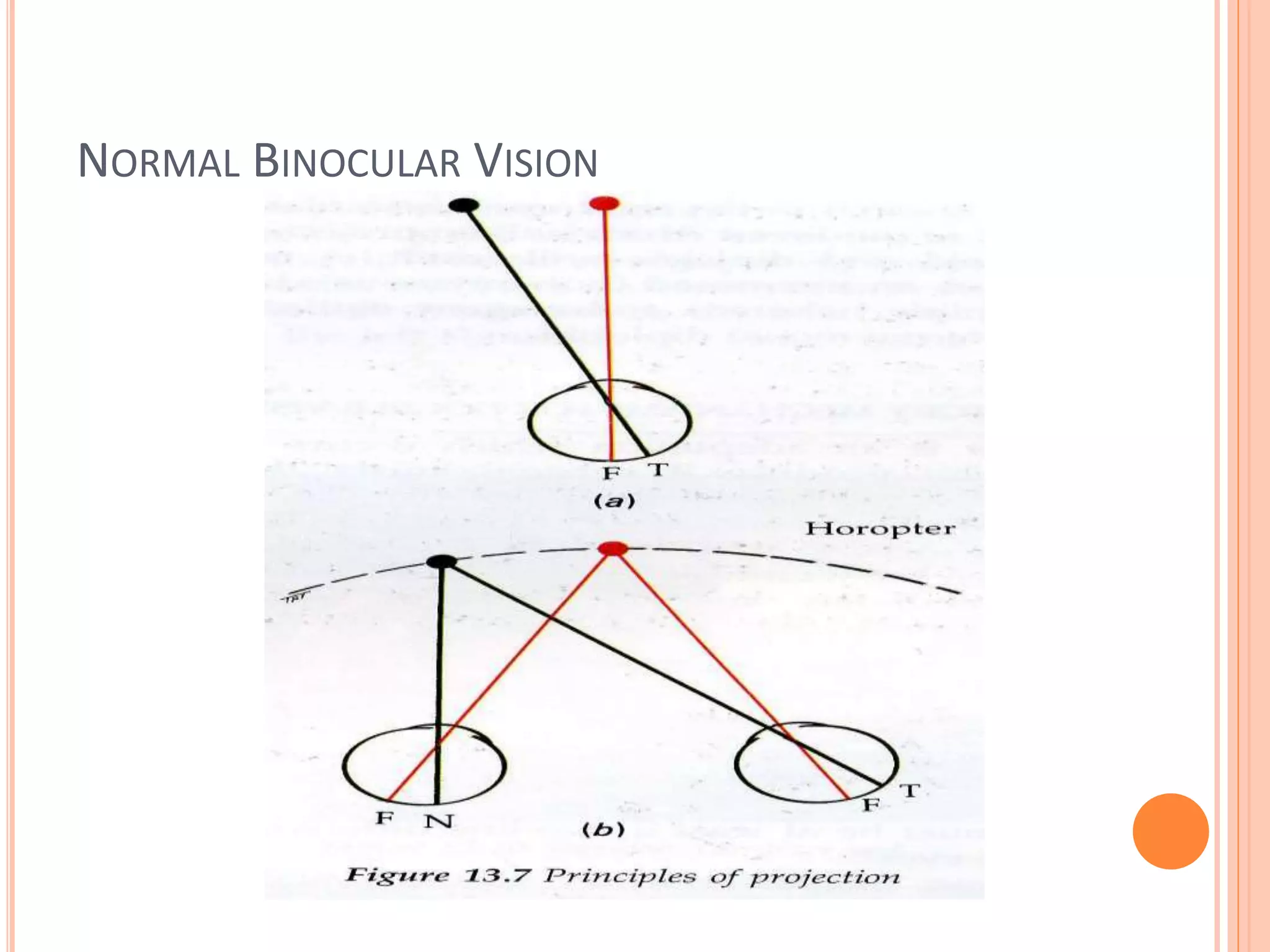 Sensory evaluation of squint
