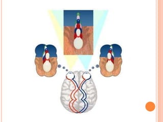 Visual Squint Sensory evaluation of squint | PPTX