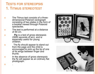 Timus Test Sensory evaluation of squint | PPTX