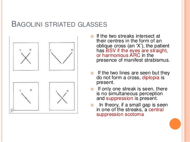 Bagolini Striated Glasses Test Bagolini Striated Glasses Test