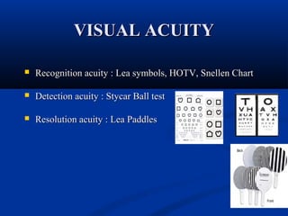 Detection Acuity Examples Sensory & motor evaluation of strabismus | PPT