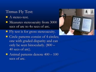 Timus Test Sensory & motor evaluation of strabismus | PPT