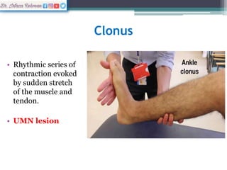 Left Clonus Sensory & Motor Examinations.pptx