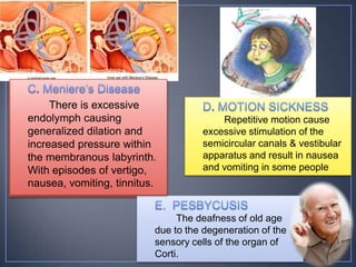 There is excessive
endolymph causing                       Repetitive motion cause
generalized dilation and            excessive stimulation of the
increased pressure within           semicircular canals & vestibular
the membranous labyrinth.           apparatus and result in nausea
With episodes of vertigo,           and vomiting in some people
nausea, vomiting, tinnitus.


                               The deafness of old age
                          due to the degeneration of the
                          sensory cells of the organ of
                          Corti.
 