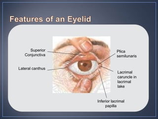 Superior                 Plica
   Conjunctiva                semilunaris


Lateral canthus
                              Lacrimal
                              caruncle in
                              lacrimal
                              lake


                  Inferior lacrimal
                       papilla
 