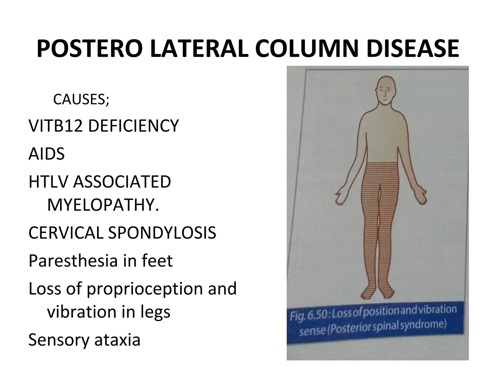 POSTERO LATERAL COLUMN DISEASE
CAUSES;
VITB12 DEFICIENCY
AIDS
HTLV ASSOCIATED
MYELOPATHY.
CERVICAL SPONDYLOSIS
Paresthesia in feet
Loss of proprioception and
vibration in legs
Sensory ataxia
 