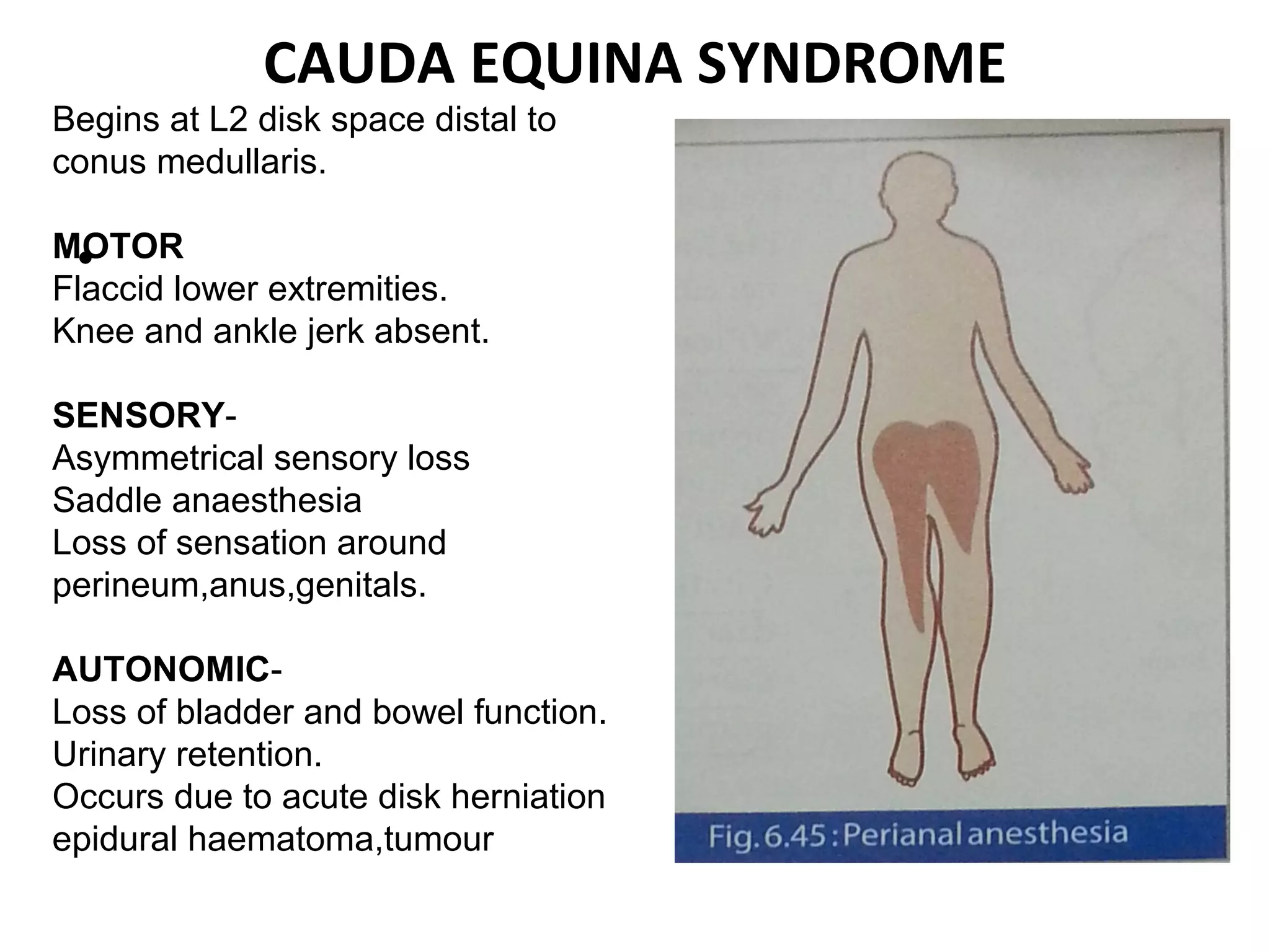 CAUDA EQUINA SYNDROME
•
Begins at L2 disk space distal to
conus medullaris.
MOTOR
Flaccid lower extremities.
Knee and ankle jerk absent.
SENSORY-
Asymmetrical sensory loss
Saddle anaesthesia
Loss of sensation around
perineum,anus,genitals.
AUTONOMIC-
Loss of bladder and bowel function.
Urinary retention.
Occurs due to acute disk herniation
epidural haematoma,tumour
 
