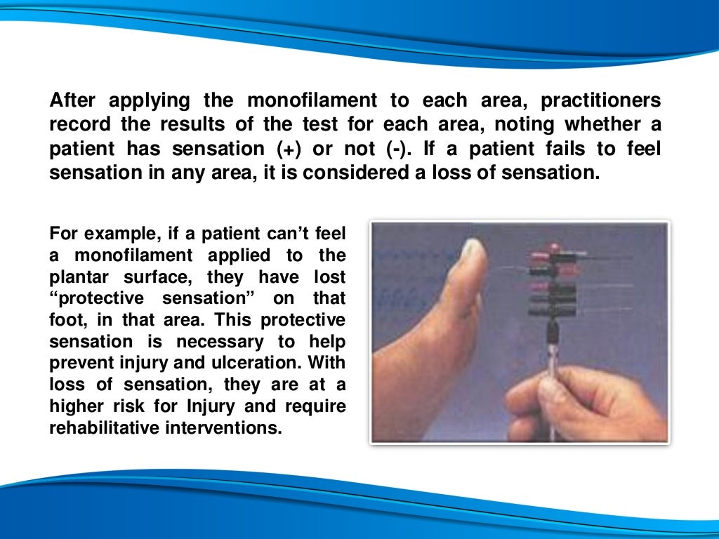 Sensory Testing Using Monofilaments For Diabetes And Carpal Tunnel Patients