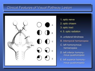 Special Sensory System | PPT