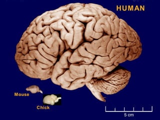 Human Chick SENSORY SYSTEM AND DISORDERS | PPT