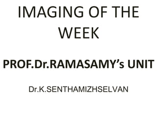 IMAGING OF THE WEEKPROF.Dr.RAMASAMY’s UNITDr.K.SENTHAMIZHSELVAN 