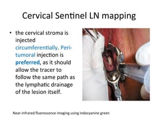 Cervical	
  Sen$nel	
  LN	
  mapping	
  
•  the	
  cervical	
  stroma	
  is	
  
injected	
  
circumferen$ally.	
  Peri-­‐
tumoral	
  injec$on	
  is	
  
preferred,	
  as	
  it	
  should	
  
allow	
  the	
  tracer	
  to	
  
follow	
  the	
  same	
  path	
  as	
  
the	
  lympha$c	
  drainage	
  
of	
  the	
  lesion	
  itself.	
  
Near-­‐infrared	
  ﬂuorescence	
  imaging	
  using	
  indocyanine	
  green	
  
	
  
 