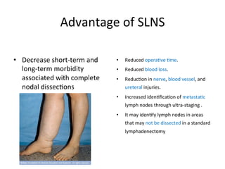 Advantage	
  of	
  SLNS	
  
•  Decrease	
  short-­‐term	
  and	
  
long-­‐term	
  morbidity	
  
associated	
  with	
  complete	
  
nodal	
  dissec$ons	
  
•  Reduced	
  opera$ve	
  $me.	
  
•  Reduced	
  blood	
  loss.	
  	
  
•  Reduc$on	
  in	
  nerve,	
  blood	
  vessel,	
  and	
  
ureteral	
  injuries.	
  	
  
•  Increased	
  iden$ﬁca$on	
  of	
  metasta$c	
  
lymph	
  nodes	
  through	
  ultra-­‐staging	
  .	
  
•  It	
  may	
  iden$fy	
  lymph	
  nodes	
  in	
  areas	
  
that	
  may	
  not	
  be	
  dissected	
  in	
  a	
  standard	
  
lymphadenectomy	
  
 