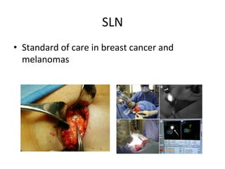 SLN	
  
•  Standard	
  of	
  care	
  in	
  breast	
  cancer	
  and	
  
melanomas	
  
 