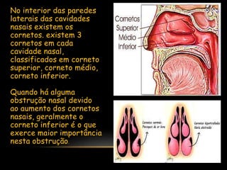 No interior das paredes
laterais das cavidades
nasais existem os
cornetos. existem 3
cornetos em cada
cavidade nasal,
classificados em corneto
superior, corneto médio,
corneto inferior.
Quando há alguma
obstrução nasal devido
ao aumento dos cornetos
nasais, geralmente o
corneto inferior é o que
exerce maior importância
nesta obstrução.
 