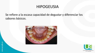 HIPOGEUSIA
Se refiere a la escasa capacidad de degustar y diferenciar los
sabores básicos.
 
