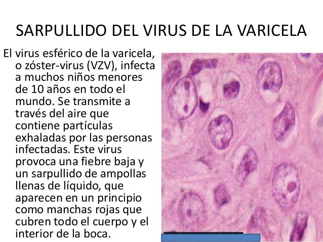 Por qué que están enfermo de la psoriasis no están enfermo del cáncer