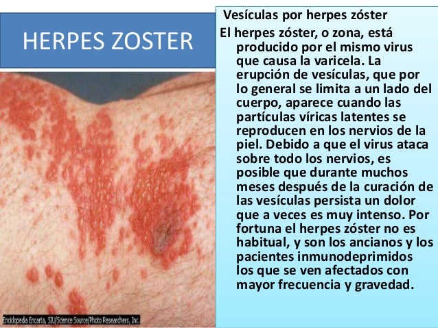 En los salones de belleza blanquean la piel