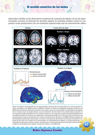 El sentido numérico de los bebés
observaban cambios en las dimensiones numéricas de conjuntos de objetos. El uso de espec-
troscopios cercanos al infrarrojo les permitió registrar la actividad cerebral cortical en res-
puesta a estas proyecciones con una resolución espacial mejor que las anteriormente utiliza-
Figura 5. Evidencia del desarrollo de una representación temprana de la numerosidad en la corteza parietal de-
recha. (a) Cantlon y col. (2006) usaron un fMRI de 4 Teslas y un diseño de adaptación inspirado en Piazza y col
(2004) para localizar las respuestas corticales a los cambios, ya sea a la numerosidad o a la identidad de los objetos
de un conjunto visual. Se puede observar una clara distinción dorsal-ventral en los adultos (lado izquierdo) con
una respuesta intraparietal bilateral a los cambios numéricos y una respuesta occipito-temporal lateralizada para
el cambio de objetos. Se observa una organización ventral-dorsal similar en los niños de 4 años de edad con una
representación numérica prominente en la corteza parietal derecha. (b) Izard y col (2008) utilizaron registros de
alta densidad de potenciales relacionados a eventos y reconstrucción de la fuente cortical para monitorear la res-
puesta de los niños a los cambios en la numerosidad o en la identidad de los objetos. La corteza parietal derecha
respondió fuertemente al cambio numérico, mientras que la corteza temporal ventral respondió fuertemente a los
cambios en la identidad de los objetos. Tomado de Cantlon y col. (2006) 138
Adultos Cuatro años de edad
Cambio en el número Cambio en el objeto
Parietal derecho
Temporal ventral izquierdo
Número desviado (DN)
Número estandar (SN)
Objeto desviado (DO)
Objeto estandar (SO)
Rubén Espinoza Condor
65
,
 