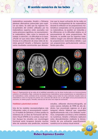 El sentido numérico de los bebés
matemáticas avanzadas. Amalric y Dehaene
plantean alternativas potenciales para expli-
car sus datos. Se sabe que las regiones fro-
to-parietales del cerebro utilizados por los
matemáticos expertos están asociados con
varios procesos cognitivos, no necesariamen-
te matemáticos, tales como la memoria de
trabajo, la atención, y la dificultad en la tarea.
¿Puede ser que estos datos reflejen las dife-
rencias en la utilización de estas redes de do-
minio general? Amalric y Dehaene reportan
varios resultados convincentes que demues-
tran que la mayor activación de las redes en
la corteza frontoparietal de los matemáticos
durante la reflexión en las proposiciones ma-
temáticas comparados con las proposiciones
no matemáticas, no pueden ser reducidas a
las diferencias en la dificultad relativa en el
procesamiento de estas proposiciones. No
obstante, es posible que los expertos mate-
máticos tengan una atención diferente hacia
las proposiciones matemáticas debido a que
son proposiciones particularmente sobresa-
lientes para ellos.
Figura 3. Superposición de las redes de la habilidad matemática con las áreas involucradas en el reconocimiento
numérico y la aritmética. Rojo, contraste de proposiciones matemáticas versus proposiciones no matemáticas en
los matemáticos; verde, contraste de los numerales arábigos versus todos los otros estímulos visuales tanto en
matemáticos como en el grupo de control; azul, contraste del cálculo con un solo dígito versus procesamiento de
oraciones, en ambos grupos. Amarillo, intersección de estos tres mapas de activación.
Habilidad y plasticidad cerebral
Uno de los modelos neuropsicológicos más
influyentes sobre el procesamiento numéri-
co, el modelo de Dehaene y Cohen predice la
existencia de un Área de Formación del Nu-
mero Visual (VNFA) en la corteza visual ven-
tral. Aunque los estudios con neuroimagen
funcional serán incapaces durante muchos
años de sustentar esta predicción, recientes
estudios, utilizando electrocorticografía, así
como nuevos métodos de fMRI de alta de-
dición, han encontrado regiones en el giro
temporal inferior bilateral que responden
significativamente más a los símbolos numé-
ricos, comparados con letras y otros símbolos
no numéricos. Amalric y Dehaene replicaron
estos descubrimientos mediante la demos-
tración de una activación específicamente
numérica en la corteza visual ventral
Rubén Espinoza Condor
75
,
 