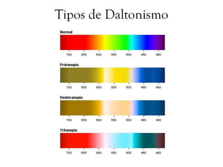 Tipos de Daltonismo
 