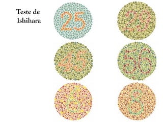 Teste de
Ishihara
 