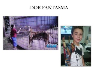 DOR FANTASMA
 