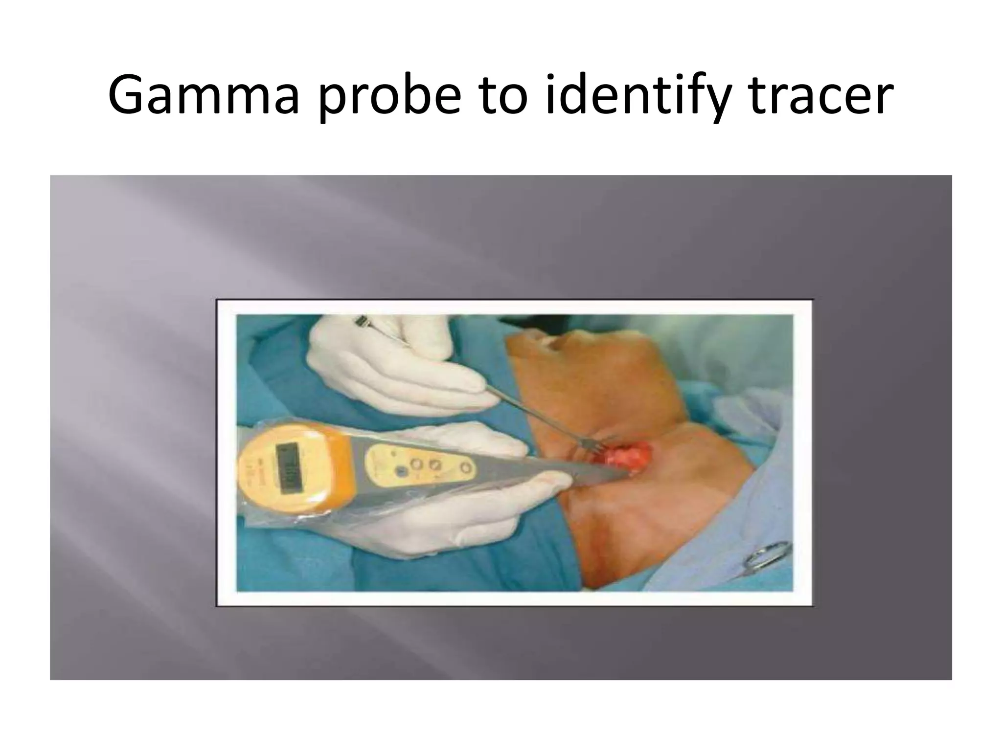 Gamma probe to identify tracer
 