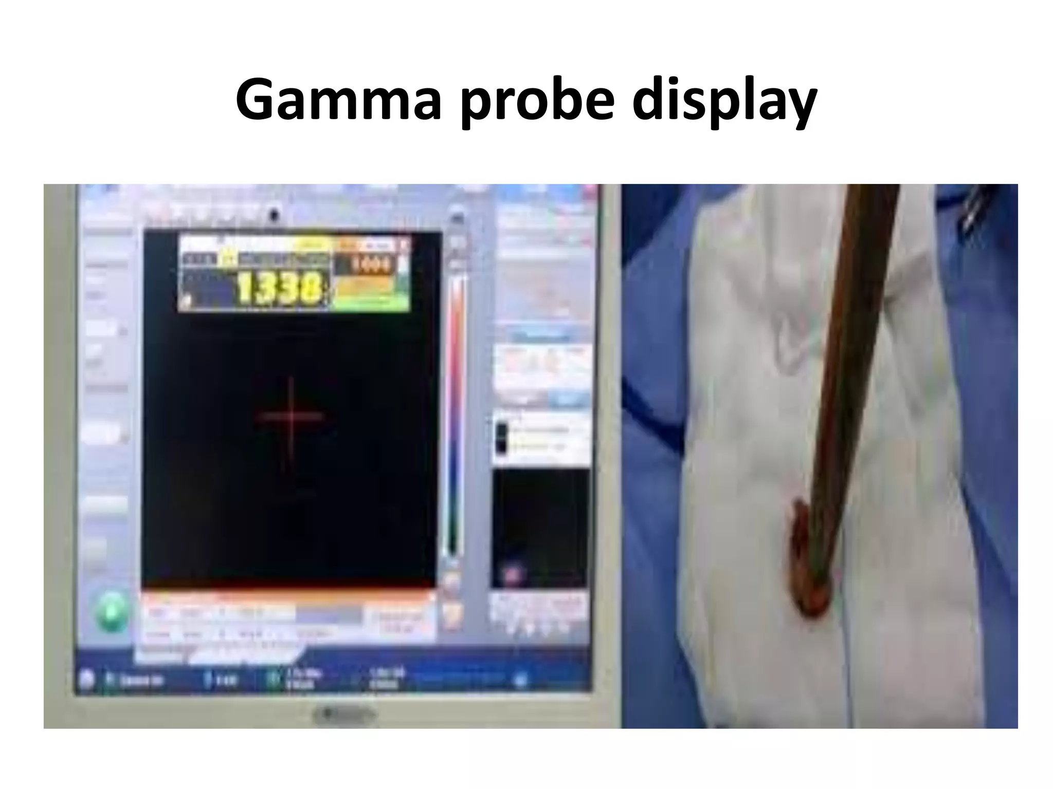 Gamma probe display
 