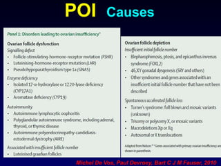 POI Causes
Michel De Vos, Paul Devroey, Bart C J M Fauser, 2010
 