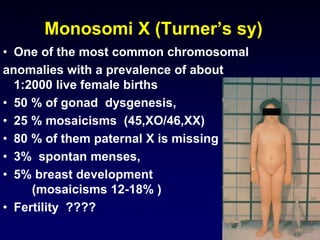 Monosomi X (Turner’s sy)
• One of the most common chromosomal
anomalies with a prevalence of about
1:2000 live female births
• 50 % of gonad dysgenesis,
• 25 % mosaicisms (45,XO/46,XX)
• 80 % of them paternal X is missing
• 3% spontan menses,
• 5% breast development
(mosaicisms 12-18% )
• Fertility ????
 