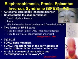• Autosomal dominantly inherited disorder,
• Characteristic facial abnormalities:
• Small palpebral fissures,
• Ptosis
• skinfold running inward and upward from the lower lid.
• Two forms of BPES exist:
• Type I: ovarian failure. Only females are affected.
• Type II: only facial abnormalities are present
Zlotogora et al., 1983
• 3q22-q23
• FOXL2 gene mutation.
• FOXL2: important role in the early stages of
ovarian differentiation and ovarian function
• A role in cholesterol metabolism and
steroidogenesis in the ovary???
Crisponi 2001
Blepharophimosis, Ptosis, Epicantus
Inversus Syndrome (BPES) - POI
 