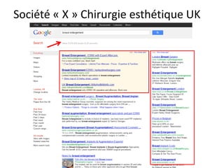 Société « X » Chirurgie esthétique UK
 