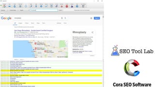 Easy Backlinks
 