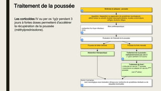 Les corticoïdes IV ou per os 1g/jr pendant 3
jours à fortes doses permettent d'accélérer
la récupération de la poussée
(méthylprednisolone).
Traitement de la poussée
 